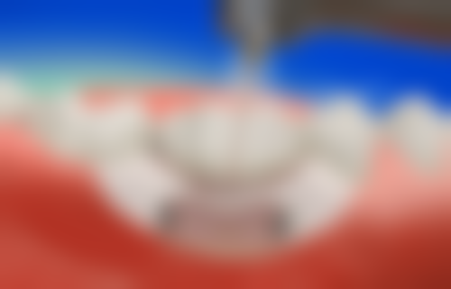 潍坊潍城孙爱华口腔怎么预约