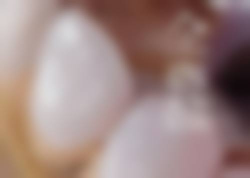 全口种植牙有哪些特殊情况呢？