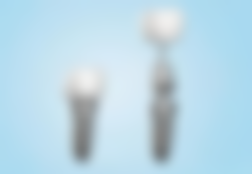 50岁地包天怎么治疗？可通过正畸正颌联合治疗、佩戴活动矫治器等方法改善！ 