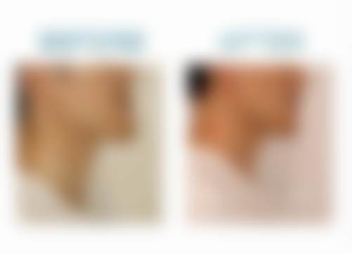 北京禾禾口腔门诊部李志鹏医生擅长项目