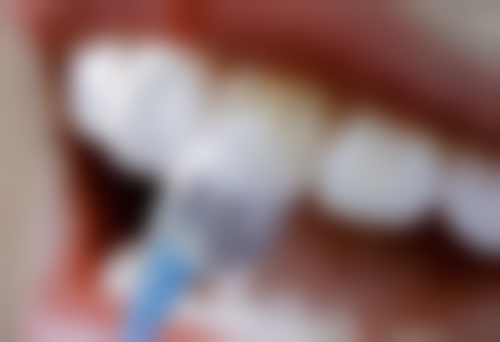 临汾尧都博雅口腔路雅琴医生牙齿矫正技术怎么样?