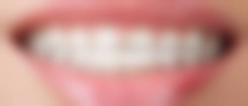 武汉牙达人口腔医院侯寿安医生隐形矫正技术怎么样？