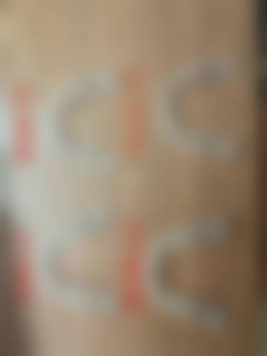 哪些场景无需拔牙矫正呢？