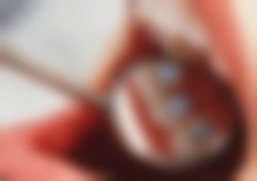 福州牙美丽口腔门诊部怎么预约