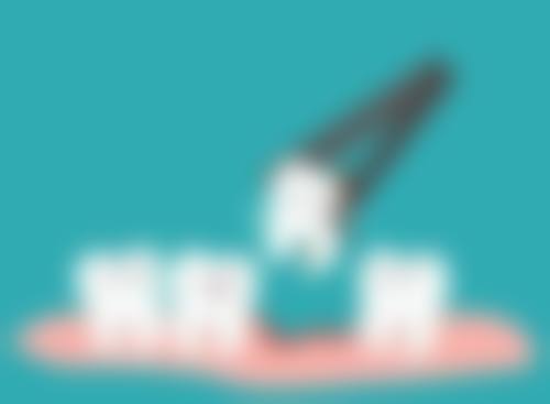 烂牙根有没有替代治疗方案呢?