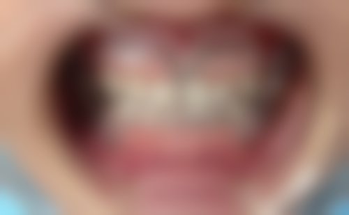 江苏南通如皋雅荣口腔口碑评价怎么样?