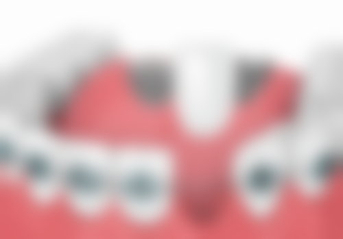 拔牙创是怎么愈合的呢？