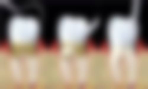 内江牙之家口腔诊所黄俊医生擅长项目