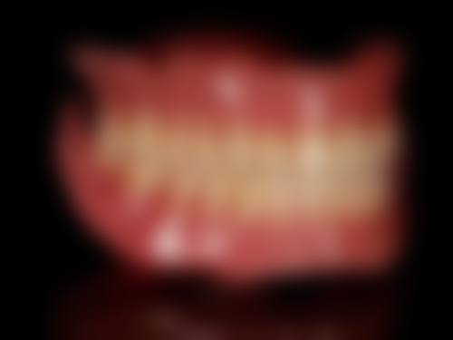 拔牙第二天有点疼正常吗？一般来说属正常现象，做好护理疼痛会逐渐缓解 