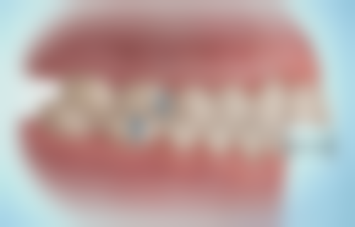 河南洛阳幼亨口腔门诊部怎么预约：