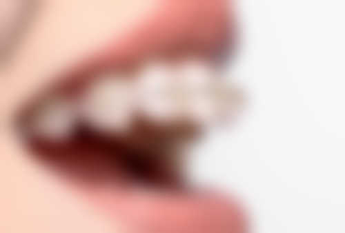 安阳北关添悦口腔门诊部的隐适美隐形矫正技术如何？