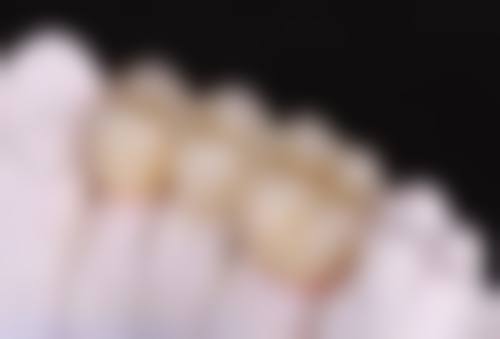 宁波现代口腔门诊部叶文婕医生隐适美隐形矫正技术怎么样?