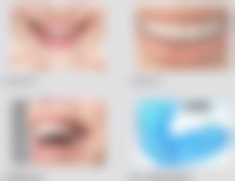 乌鲁木齐美奥口腔门诊部（天山区光明路店）朱立功医生患者评价