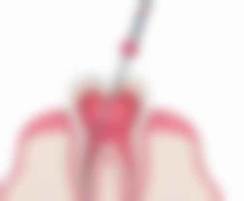 日常护理与预防方面，怎样减轻牙齿矫正疼痛？