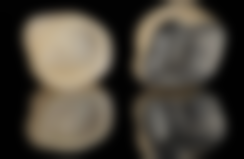 化州市凯美口腔口碑评价怎么样?