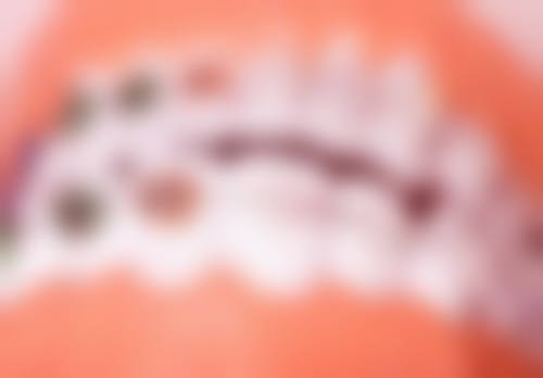 报销有哪些前提条件呢？