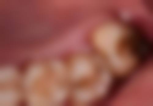 深圳优贝口腔诊所朱江城医生预约挂号指南