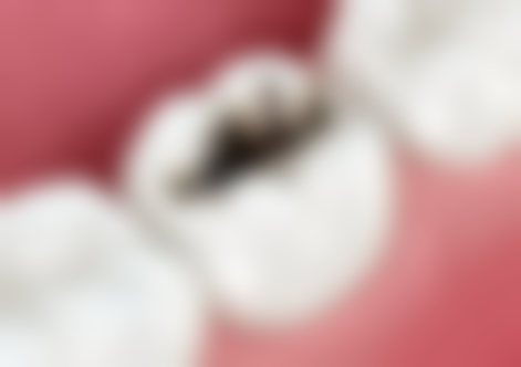 湖北鄂州柳林口腔正规吗？