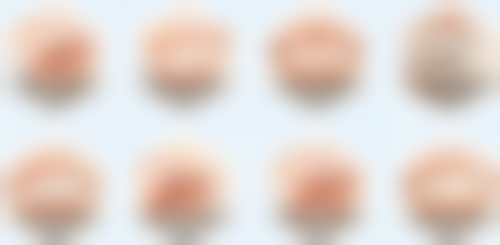 23岁了还能去做牙齿矫正吗？当然可以，矫正牙齿无年龄限制，23岁做正当时！ 