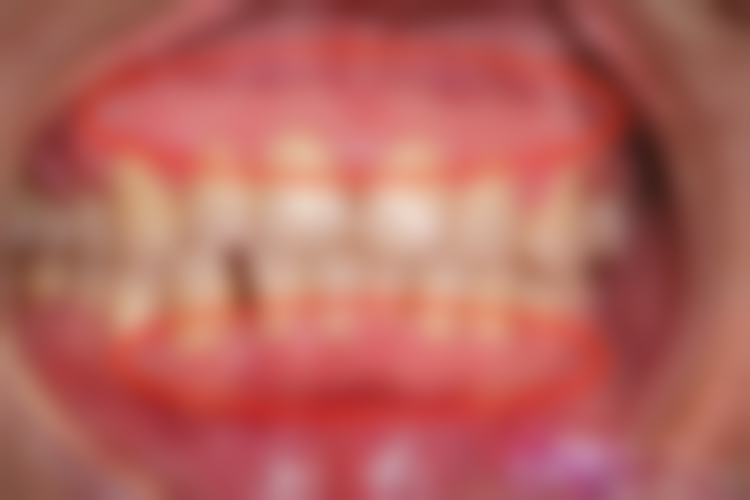 孕期口腔健康有哪些建议？