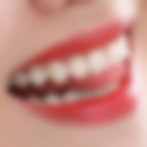 南充美佳口腔诊所苏怀风医生擅长项目