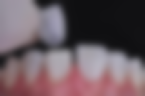 东莞横沥佳德口腔门诊收费价格表