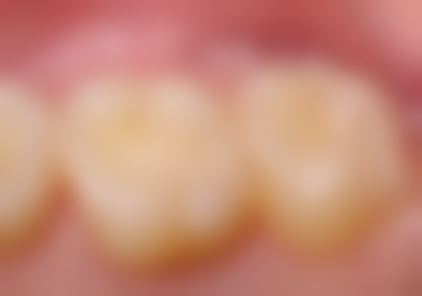 绍兴上虞维尼口腔门诊部收费价格表