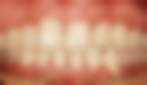 北京圣贝口腔医院王侠医生擅长项目