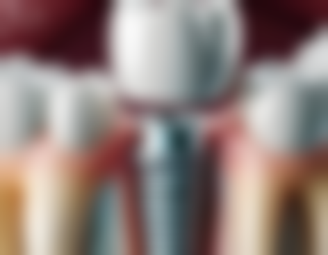 有哪些通用的处理措施呢？