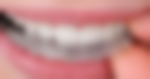 长沙拜博口腔连锁口碑评价怎么样？