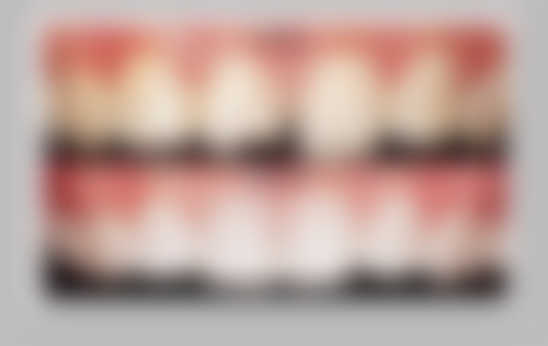 活动义齿日常该如何清洁与维护？