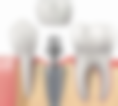 北京欢乐伯菲特口腔门诊部口碑评价怎么样？