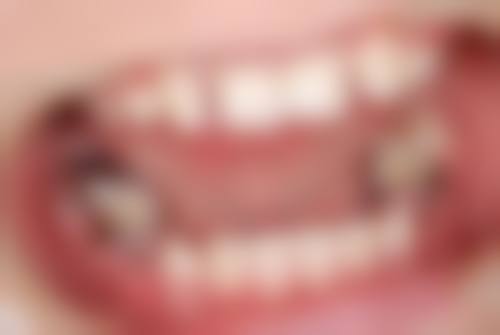 广东深圳郑益董口腔诊所正规吗？