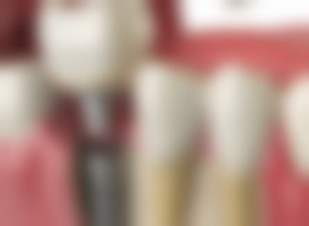 十堰郧西从兵口腔正规吗？