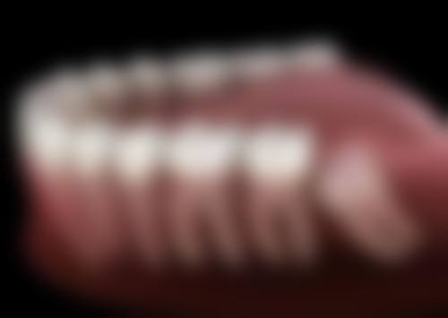 哪些人拔牙后适合吃罗红霉素？