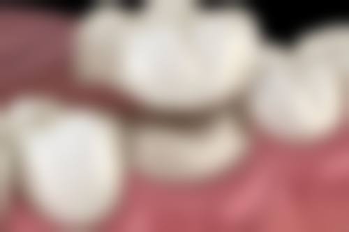 总结